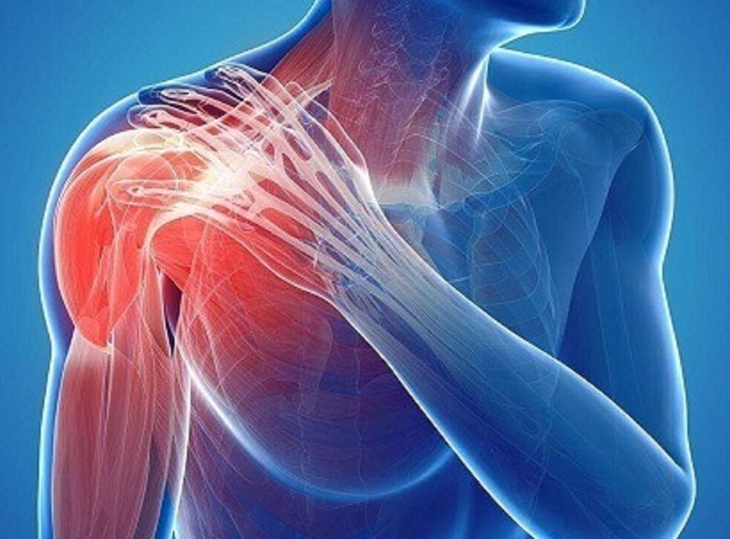 What vitamin deficiency causes shoulder pain